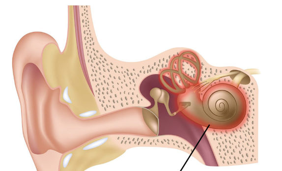 <p>Labyrinthitis</p><ul><li><p>Location: Inner ear</p></li><li><p>Symptoms: Vertigo, dizziness</p></li><li><p>Causes: Viral</p></li></ul><p></p>