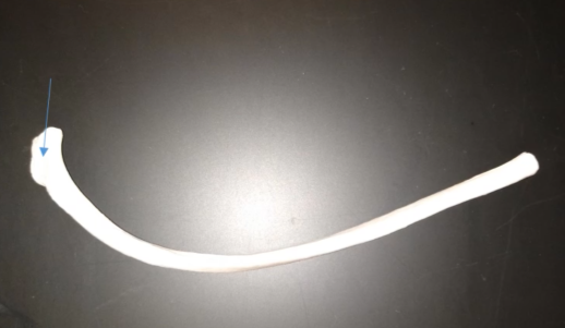 <p>What is this end of the rib</p>