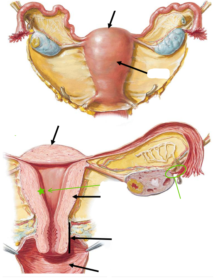 <p>Label the following diagram of the key regions of the <strong>uterus</strong></p>