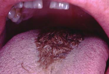 <p>This alteration is called</p>