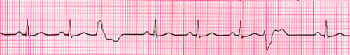<p>what waveform is this</p>