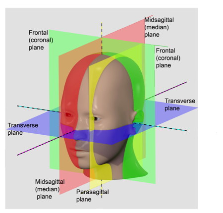<p>what planes of section is the yellow line?</p>