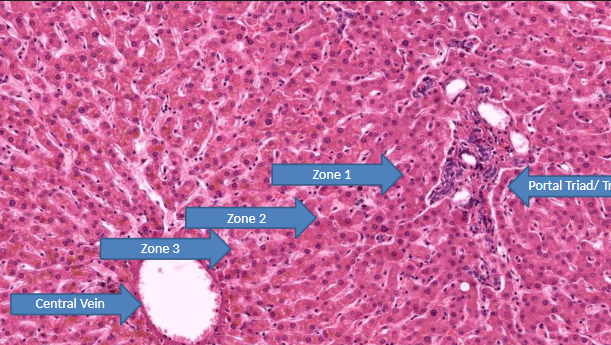 <p>what is zone 1 (peripheral/peri lobular) of liver acinus affected by 1st?</p>