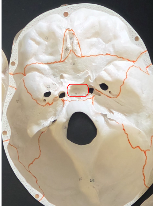 <p>What is this space under the sphenoid called? </p>