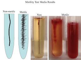 <p>Motility test </p>