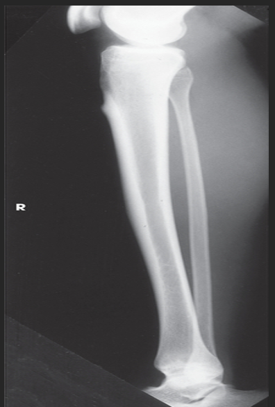 <p>Describe the position of the patient.</p>