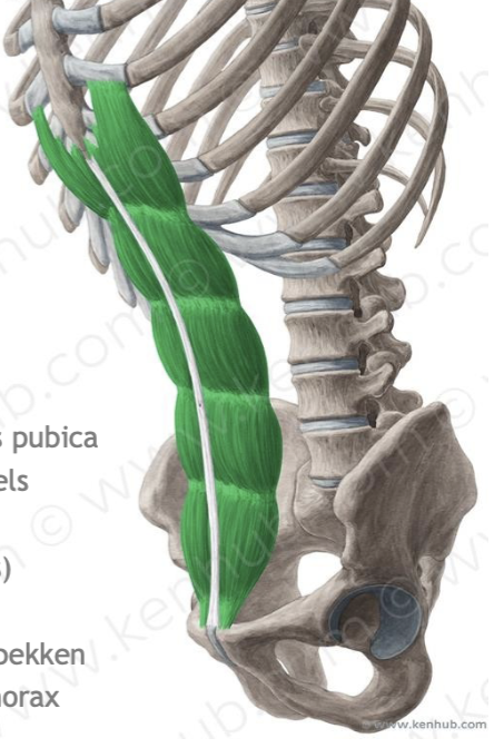 <p><span style="line-height: 17px;">Musculi abdominis</span><span style="line-height: 17px; background-color: var(--clrSelection,#c6c6c6) !important;">&nbsp;</span></p><p class="Paragraph SCXW55143553 BCX4" style="text-align: left;"><span style="line-height: 17px; background-color: var(--clrSelection,#c6c6c6) !important;">&nbsp;</span></p><p class="Paragraph SCXW55143553 BCX4" style="text-align: left;"><span style="line-height: 17px;">Rechte buikspieren</span><span style="line-height: 17px; background-color: var(--clrSelection,#c6c6c6) !important;">&nbsp;</span></p><p class="Paragraph SCXW55143553 BCX4" style="text-align: left;"><span style="line-height: 17px; background-color: var(--clrSelection,#c6c6c6) !important;">&nbsp;</span></p><p class="Paragraph SCXW55143553 BCX4" style="text-align: left;"><span style="line-height: 17px;">M. rectus abdominis</span><span style="line-height: 17px; background-color: var(--clrSelection,#c6c6c6) !important;">&nbsp;</span></p>