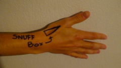 <p>snuffbox tenderness</p><p>if tender, ask for specific XR of this area</p>