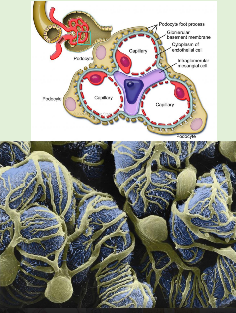 <p><span style="color: purple;">Podocytes are specialised epithelial cells</span></p><p></p><p>Located on the “abluminal” surface of the capillary loop</p><p></p><p>Podocytes have numerous processes, like tentacles, that surround the capillaries</p><p></p><p><span style="color: purple;"><strong>Foot processes</strong></span> (FP) of podocytes (epithelial cell in i<span style="color: purple;">nner layer of Bowman’s capsul</span>e) devoid of organelles except m<span style="color: purple;">icrotubules/ microfilaments</span></p><p></p><p>Podocyte FPs comprise a functionin<span style="color: purple;">g <strong>slit diaphragm </strong>(SD)</span> in between, a meshwork of proteins actively participating in <span style="color: purple;">p<strong>odocyte signaling</strong></span></p><p></p><p><strong>visceral layer of bowman’s capsule</strong></p><p>Support glomerular capillaries and are part of the <span style="color: purple;">glomerular filtration barrier</span></p><p></p><p><strong>The filtration barrie</strong>r: endothelial cells/pores, basal lamina, podocytes-slit pores (slit diaphragm) between podocyte foot processes</p><p></p><p>Podocytes respond to <span style="color: purple;">hormones and growth factor</span>s that are present in the circulation</p><p>Podocytes <span style="color: purple;">work with mesangial cells</span> to support the structure and function of the glomerulus</p><p></p><p>the yellow wiggles around the pink circles are the slits</p>