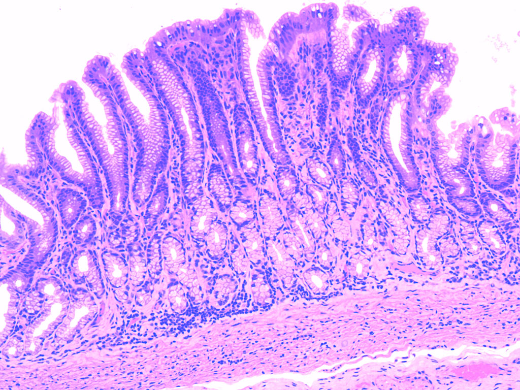 <p>pylorus of stomach</p><p></p>