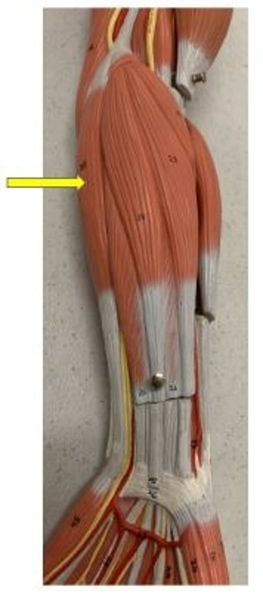 <p>flexion of wrist and adduction of hand</p>