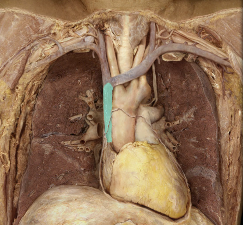 <p>Identify the feature of the caval system</p>