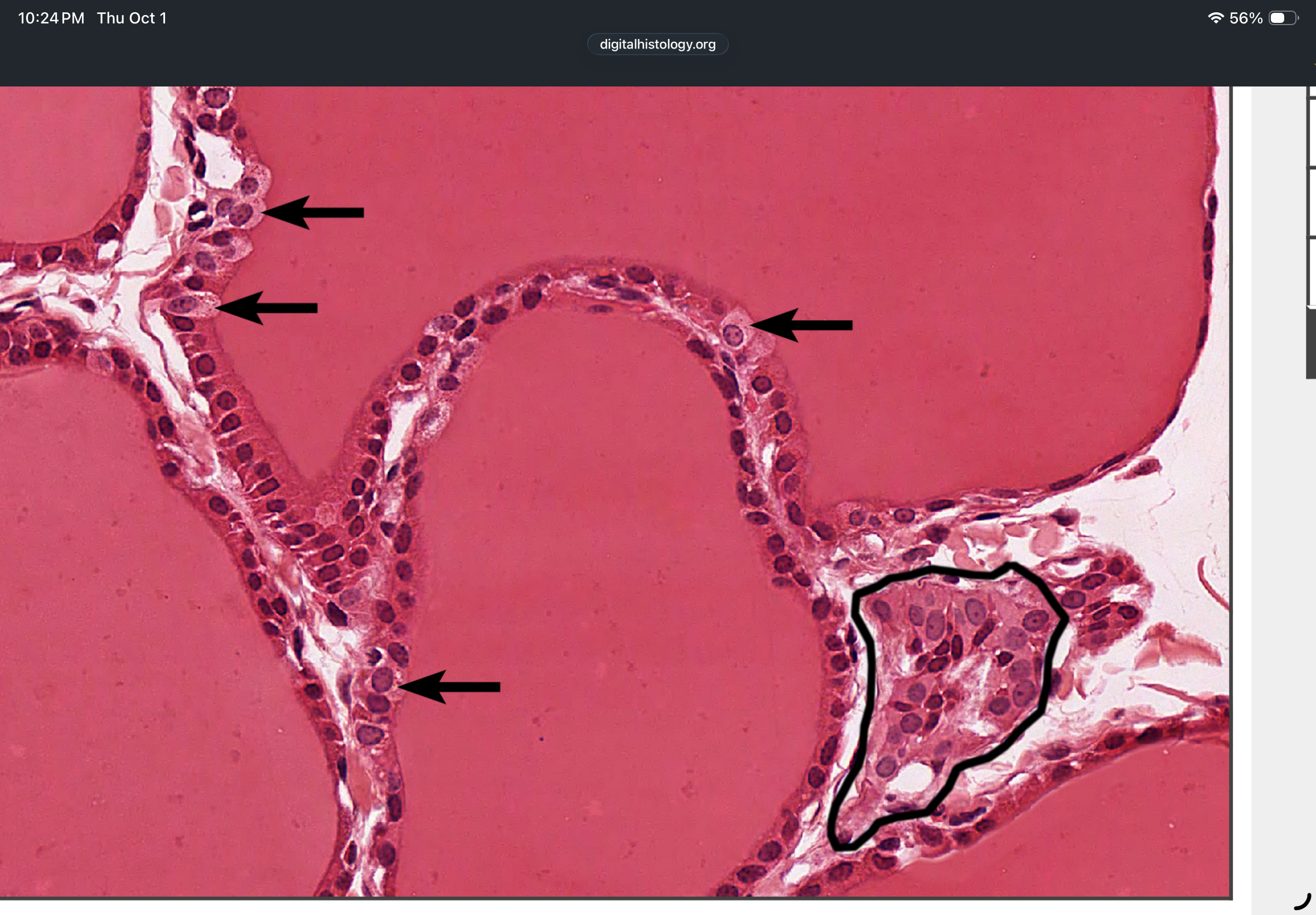 <p>What cell are the arrows pointing too in this image? </p>