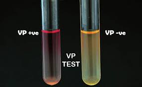 <p>Vogues-Proskauer test </p>