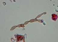 <p>Type of mold? </p>