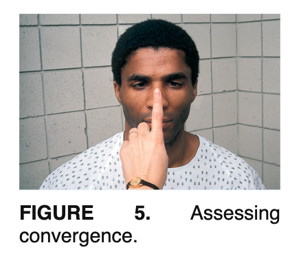 <p>The eyes should follow an object to within 5 cm of the nose (appear cross-eyed appearance)</p>