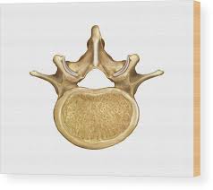 <p>What kind of vert is this?</p>