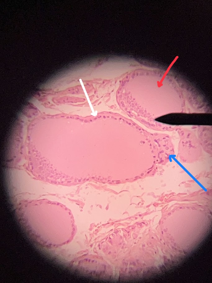 <p><span>The structure with the blue arrows depicts which part of the pituitary</span></p>