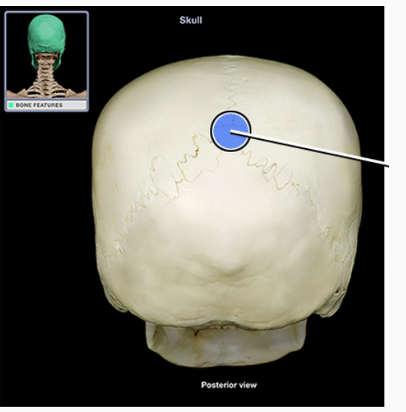 <p>What structure is indicated</p>