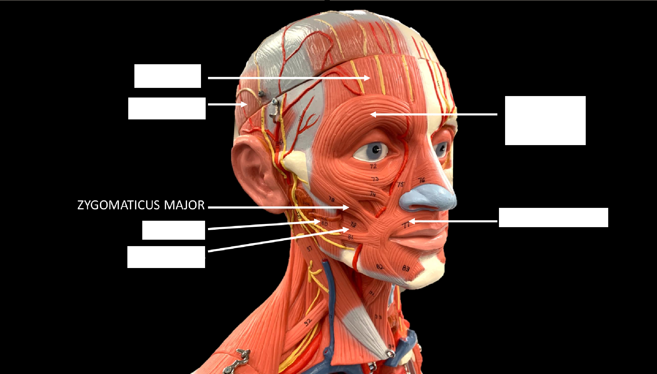 <p>ZYGOMATICUS MAJOR</p>
