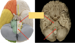 <p>What part of the brain stem is this pointing to? (INFERIOR)</p>