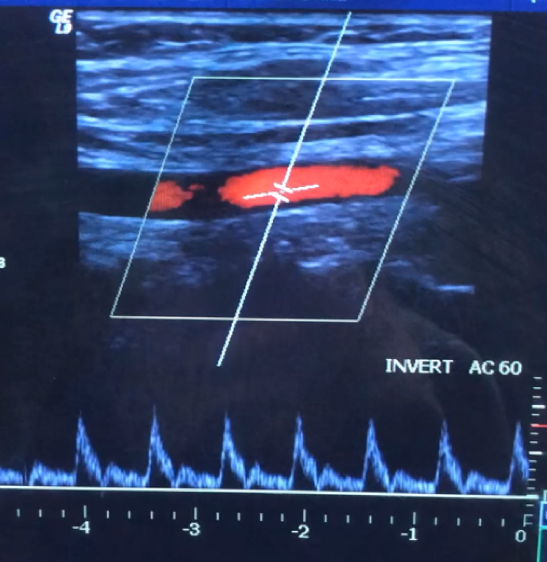 <p>Identify the vessel</p>