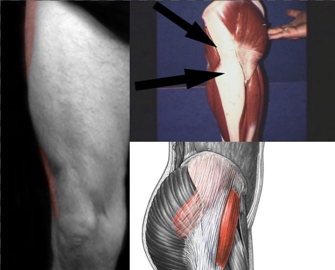 <p>What muscle is this?</p>