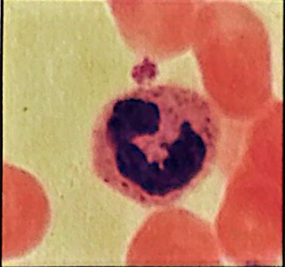 <p>neutrophilis (granulocyte) </p>