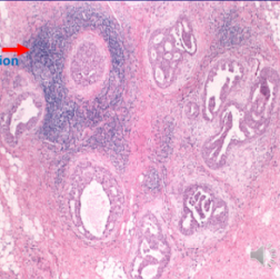 <p>What pathology?</p>