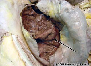 <p>what structure in the large intestine is this (be specfic)?</p>