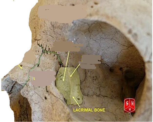 <p>Located on medial wall of socket </p>