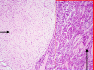 <p>Only <strong>Produces </strong>multiple hormones (ex: GH, TSH, ACTH) </p><ul><li><p>Darker side due to being made up of epithelial tissue </p></li></ul><p></p>
