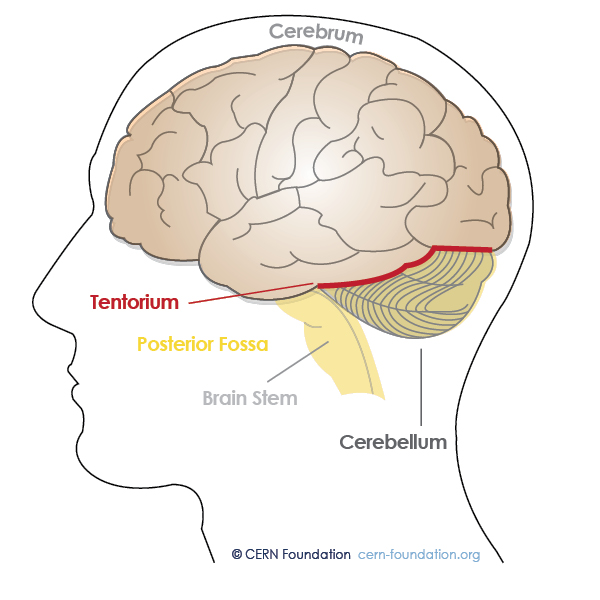 <p>The tentorium cerebelli. It is a tough, sheet-like layer of the dura mater.</p>