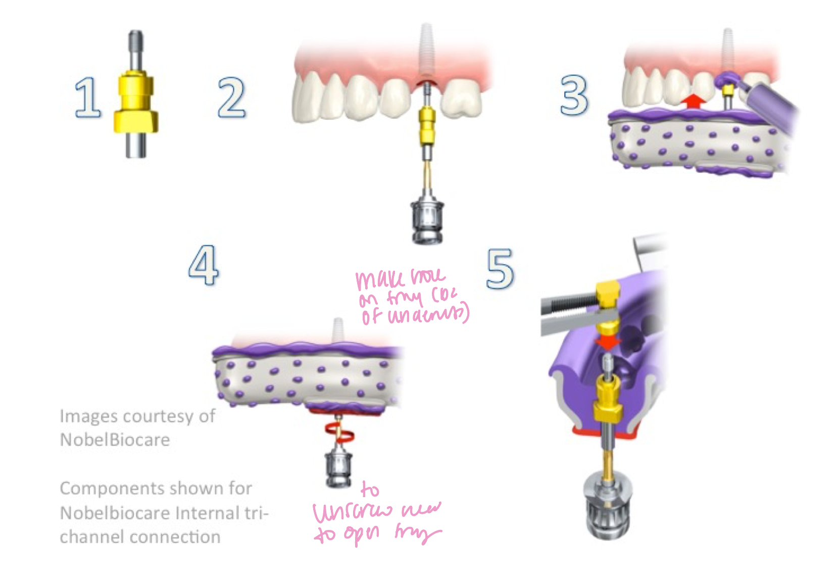 <p>ID the technique:</p>