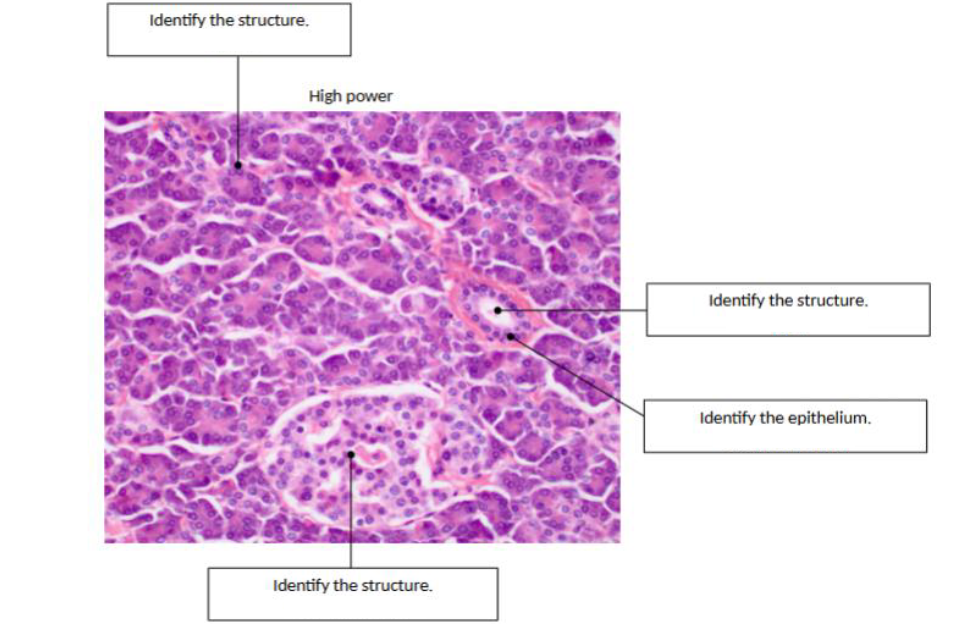<p>identify the organ </p>