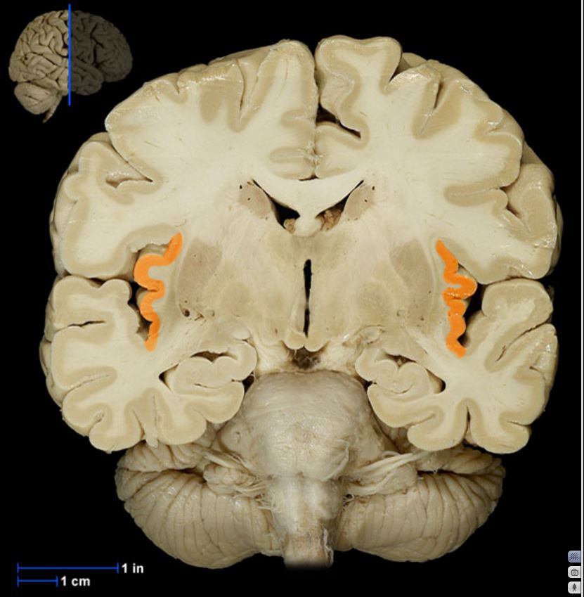 term image