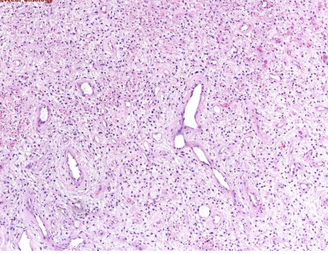 <p>Lésion oesophage</p><p>1) Diagnostic </p><p>2) histo</p>