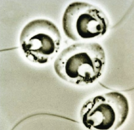 <p>the only fungi that produce motile cells (flagellated cells); fungal decomposer of plant material in wet soils, ponds, and lakes</p>