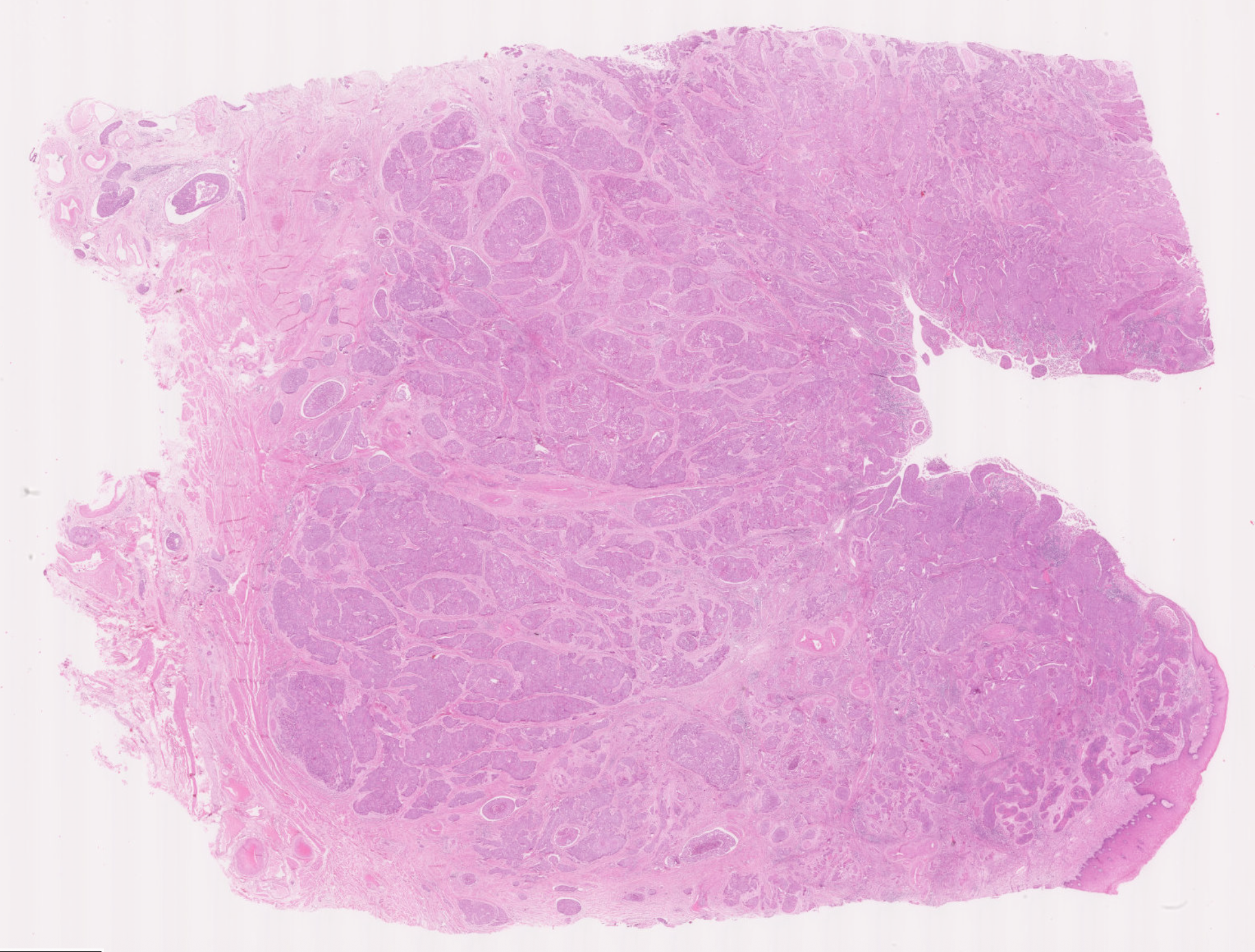 <p>Uterine Cervix</p>