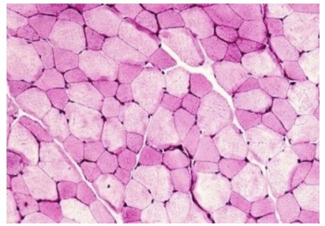 <ol><li><p>Slow-oxidative </p></li><li><p>Fast-oxidative (aka fast-oxidative-glycolytic)</p></li><li><p>Fast-glycolytic</p></li></ol><p></p>