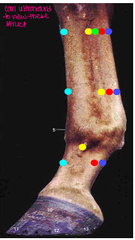 <p>Distal accessory (check) ligament</p>