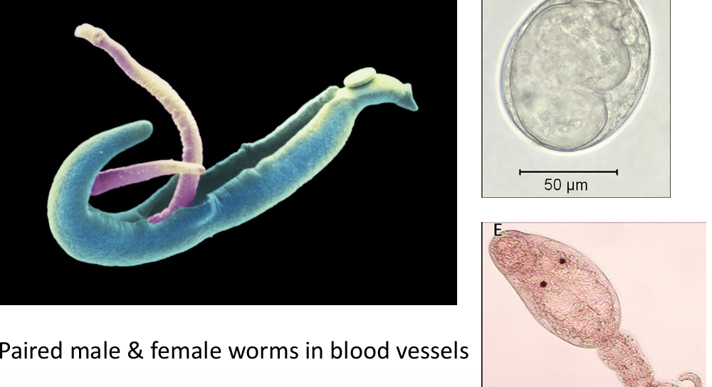 <p>Canine&nbsp;Blood&nbsp;Fluke</p><p>Causative&nbsp;agent&nbsp;of&nbsp;zoonotic&nbsp;&nbsp;“Swimmer’s&nbsp; Itch”&nbsp;</p>