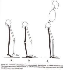 <p>Increased angle at the ankle joint.</p>