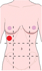 <p>right kidney, liver, gallbladder, and small intestine</p>