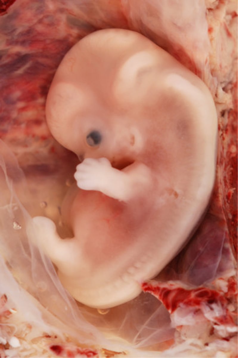 <p>fetus</p>