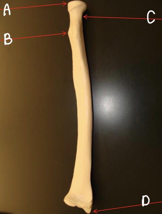 <p>What bone is this? (Name left or right, the anatomical view, and A-D)</p>