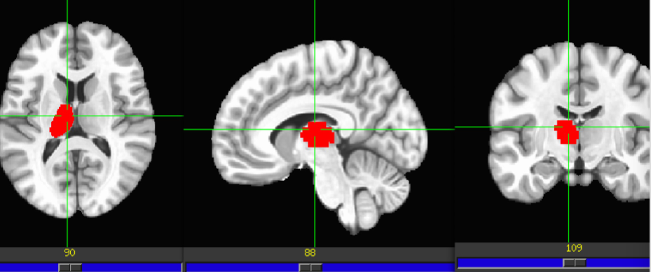 term image