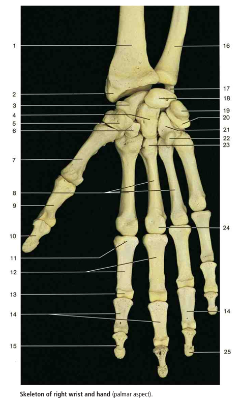 <p>#3 </p>