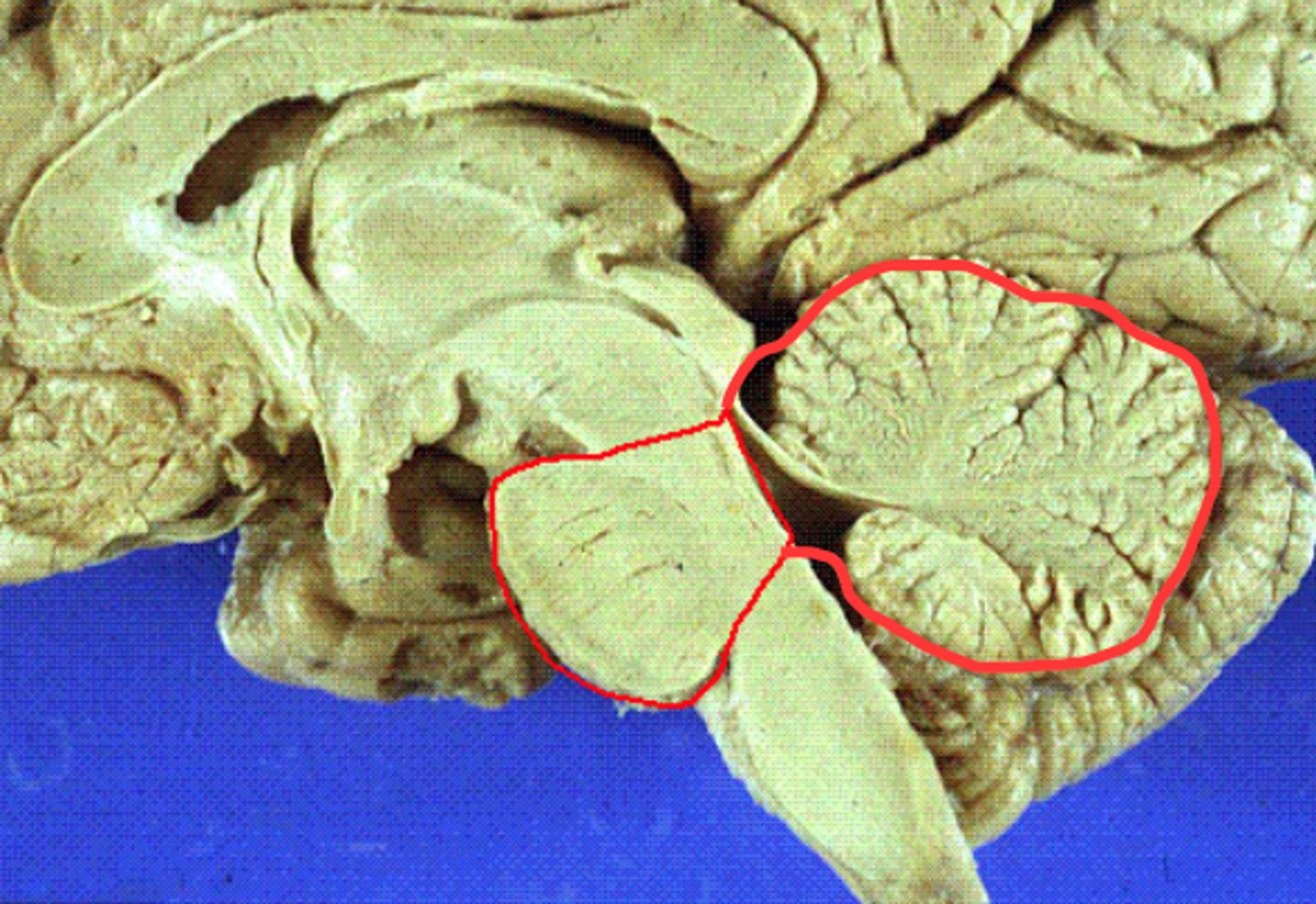 <p>Contains Pons and Cerebellum (sensorimotor control).</p>