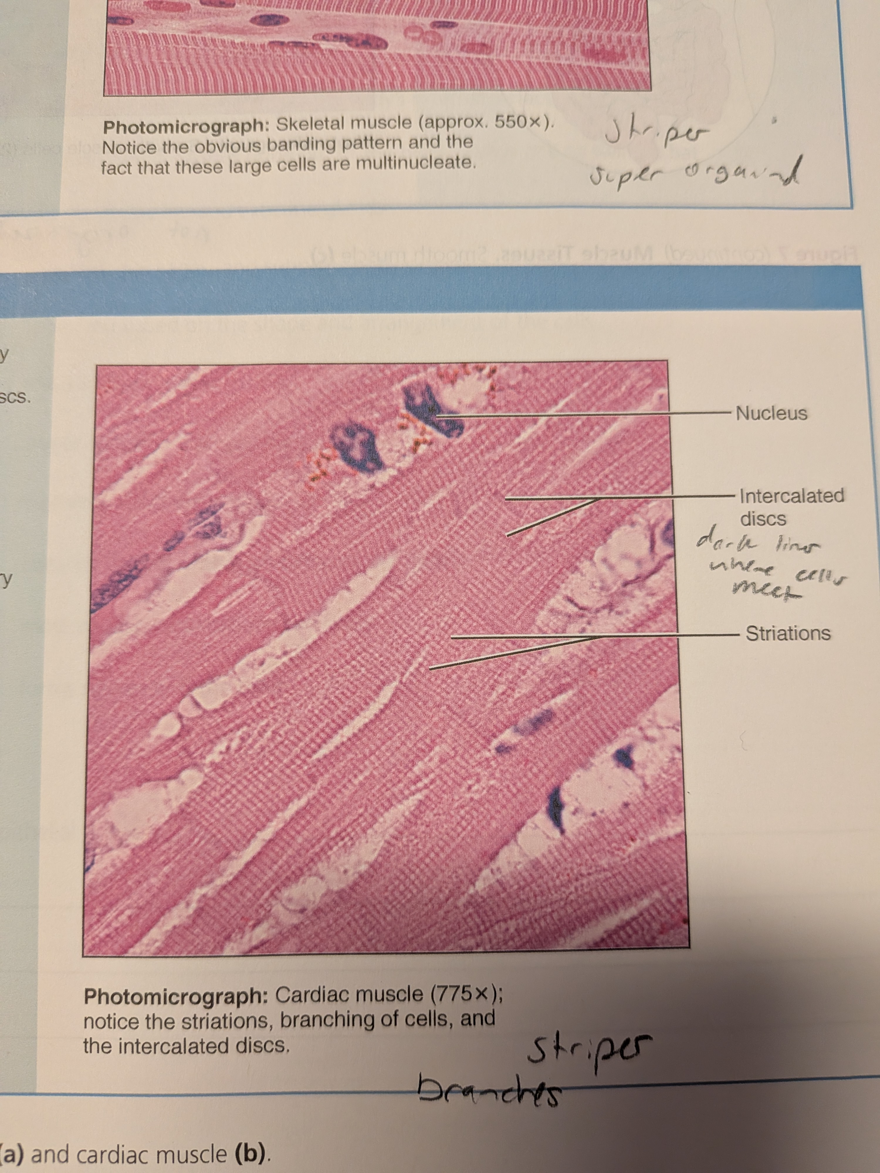 <p>cardiac muscle</p>